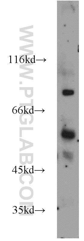 Western Blot (WB) analysis of A549 cells using BBS10 Polyclonal antibody (12421-2-AP)