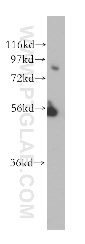 Western Blot (WB) analysis of MCF-7 cells using BBS10 Polyclonal antibody (12421-2-AP)