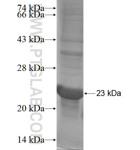 BBS10 fusion protein Ag17960 SDS-PAGE