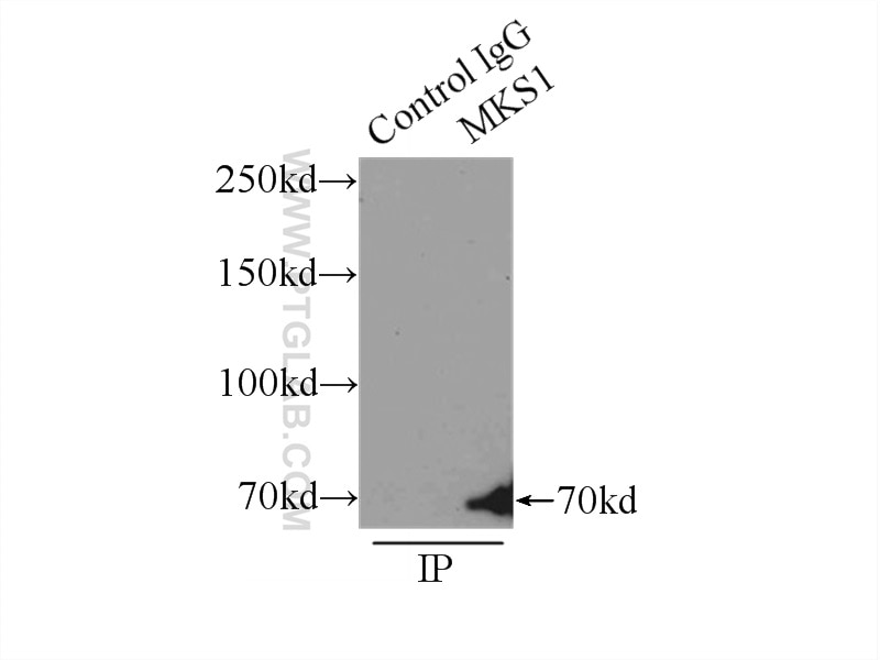 Immunoprecipitation (IP) experiment of HEK-293 cells using MKS1 Polyclonal antibody (16206-1-AP)