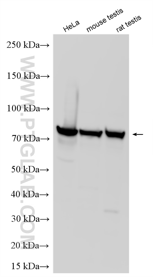 Western Blot (WB) analysis of various lysates using MKS1 Polyclonal antibody (16206-1-AP)