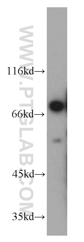 Western Blot (WB) analysis of mouse uterus tissue using MKS1 Polyclonal antibody (16206-1-AP)
