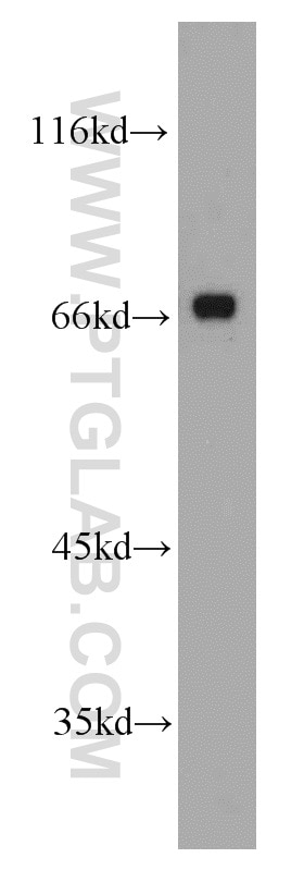 Western Blot (WB) analysis of SH-SY5Y cells using MKS1 Polyclonal antibody (16206-1-AP)