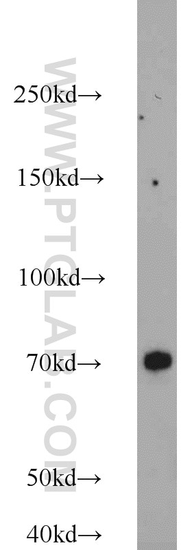 Western Blot (WB) analysis of HEK-293 cells using MKS1 Polyclonal antibody (16206-1-AP)