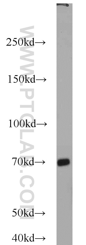 Western Blot (WB) analysis of mouse brain tissue using MKS1 Polyclonal antibody (16206-1-AP)