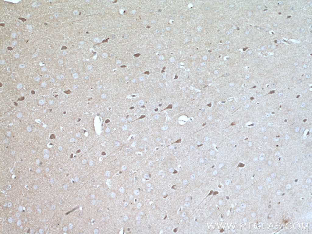 Immunohistochemistry (IHC) staining of mouse brain tissue using MKS1 Monoclonal antibody (66518-1-Ig)