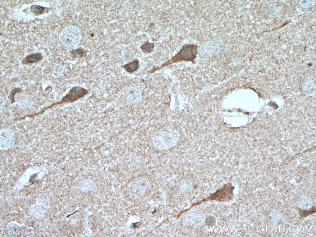 Immunohistochemistry (IHC) staining of mouse brain tissue using MKS1 Monoclonal antibody (66518-1-Ig)