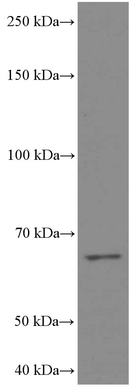 Western Blot (WB) analysis of pig brain tissue using MKS1 Monoclonal antibody (66518-1-Ig)