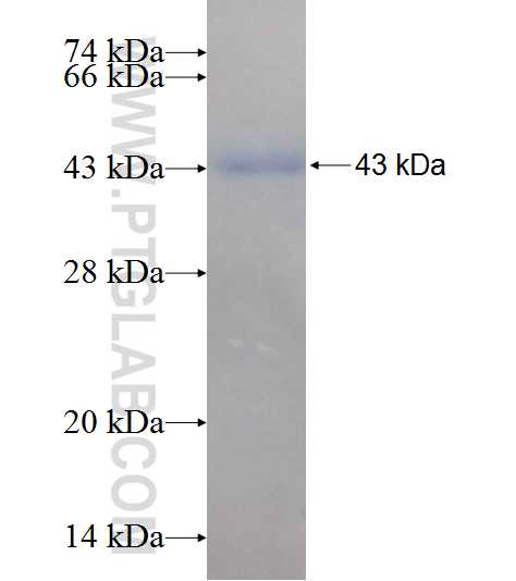 BBS13 fusion protein Ag9504 SDS-PAGE