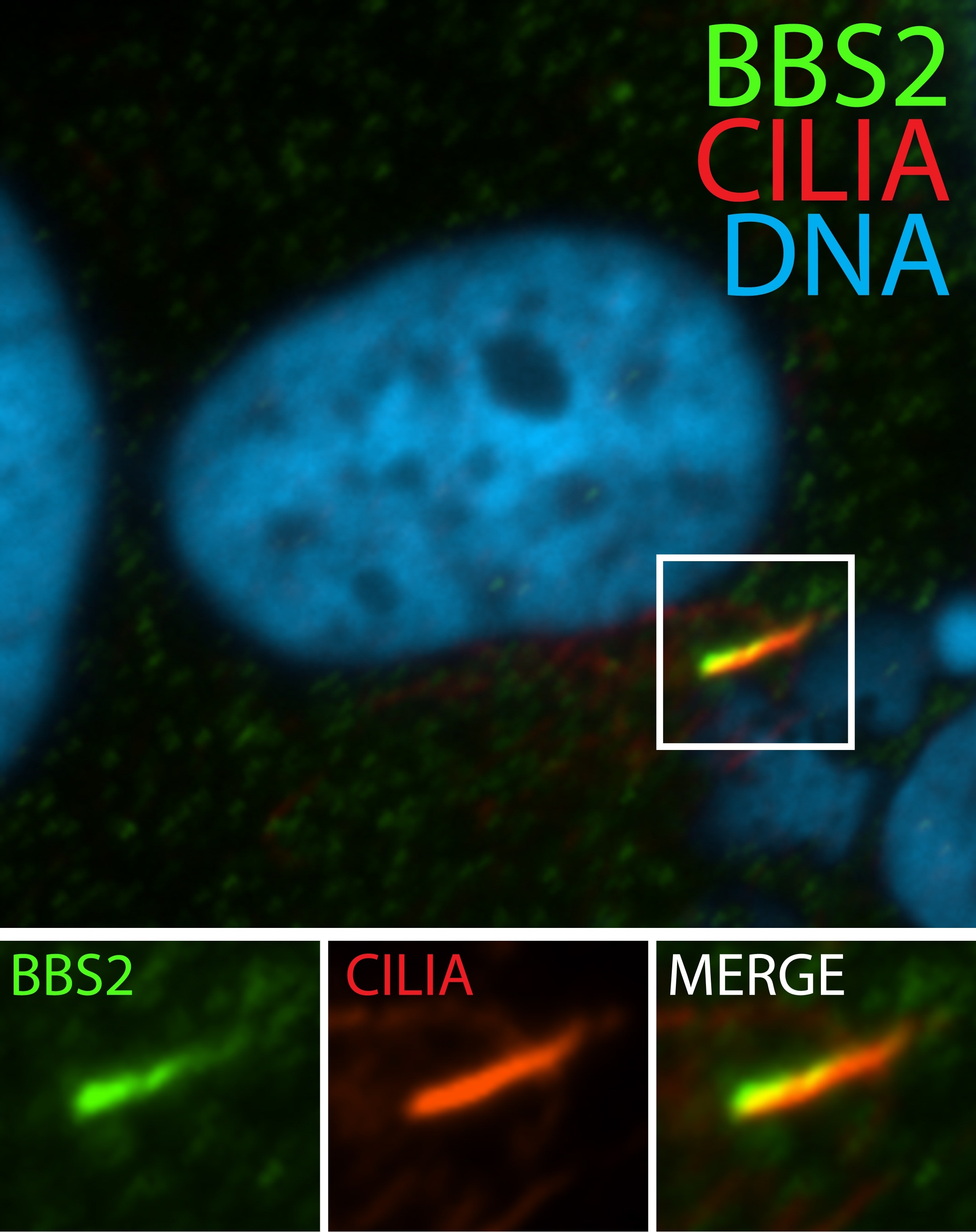 Immunofluorescence (IF) / fluorescent staining of hTERT-RPE1 cells using BBS2 Polyclonal antibody (11188-2-AP)