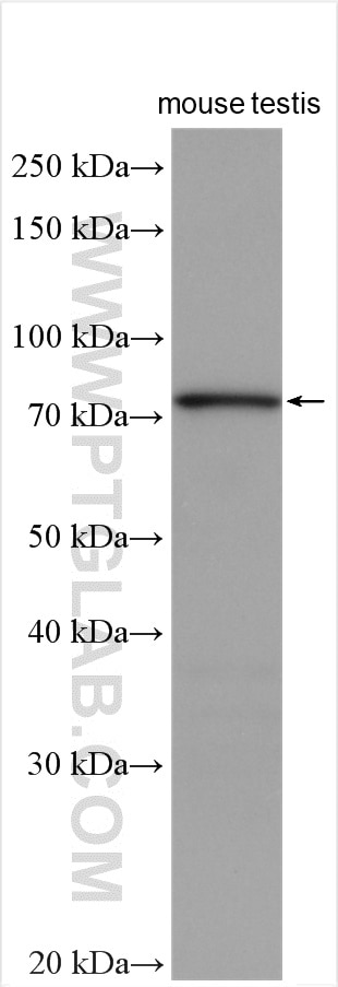 Western Blot (WB) analysis of various lysates using BBS2 Polyclonal antibody (11188-2-AP)