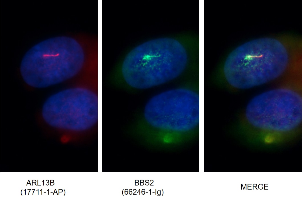 Immunofluorescence (IF) / fluorescent staining of MDCK cells using BBS2 Monoclonal antibody (66246-1-Ig)