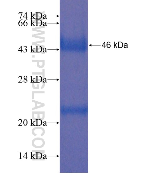 BBS2 fusion protein Ag21390 SDS-PAGE