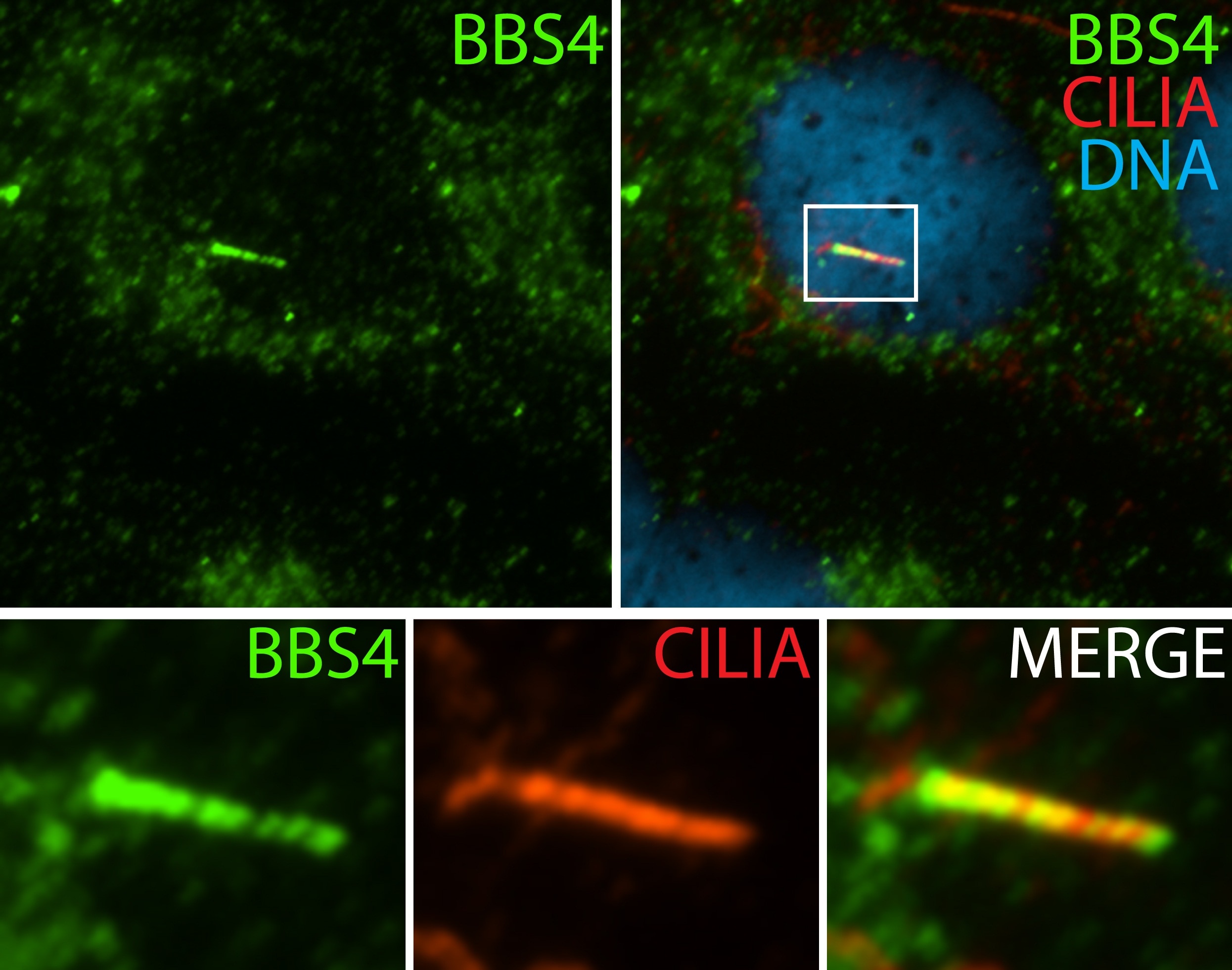 Immunofluorescence (IF) / fluorescent staining of hTERT-RPE1 cells using BBS4 Polyclonal antibody (12766-1-AP)