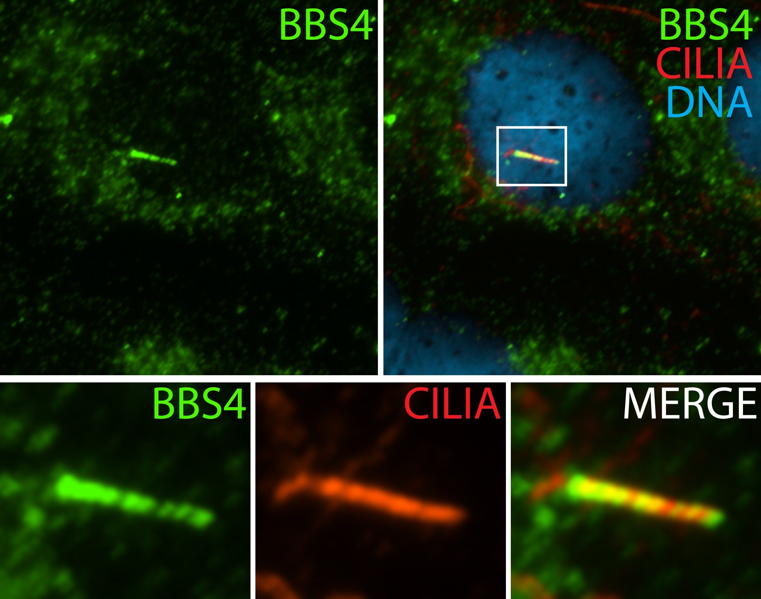 IF Staining of hTERT-RPE1 cells using 12766-1-AP