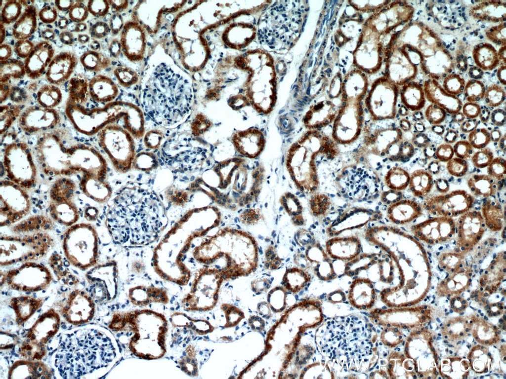 Immunohistochemistry (IHC) staining of human kidney tissue using BBS4 Polyclonal antibody (12766-1-AP)