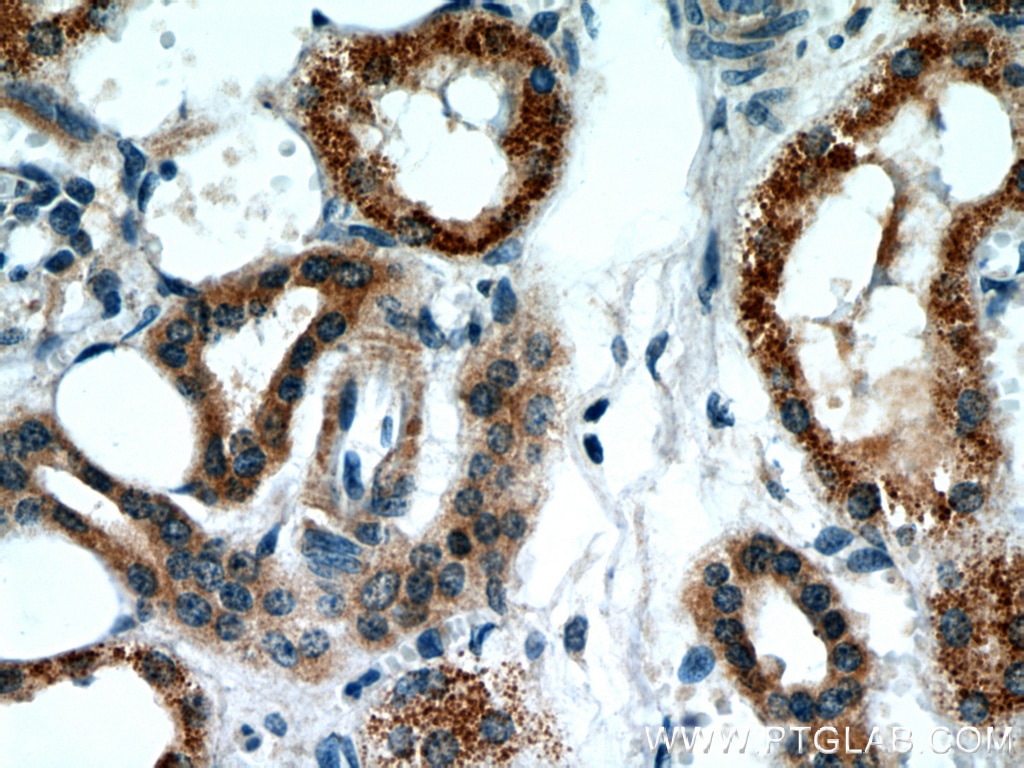 Immunohistochemistry (IHC) staining of human kidney tissue using BBS4 Polyclonal antibody (12766-1-AP)