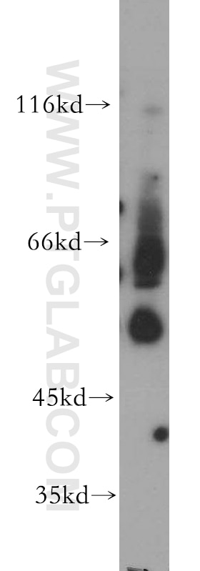 Western Blot (WB) analysis of mouse kidney tissue using BBS4 Polyclonal antibody (12766-1-AP)