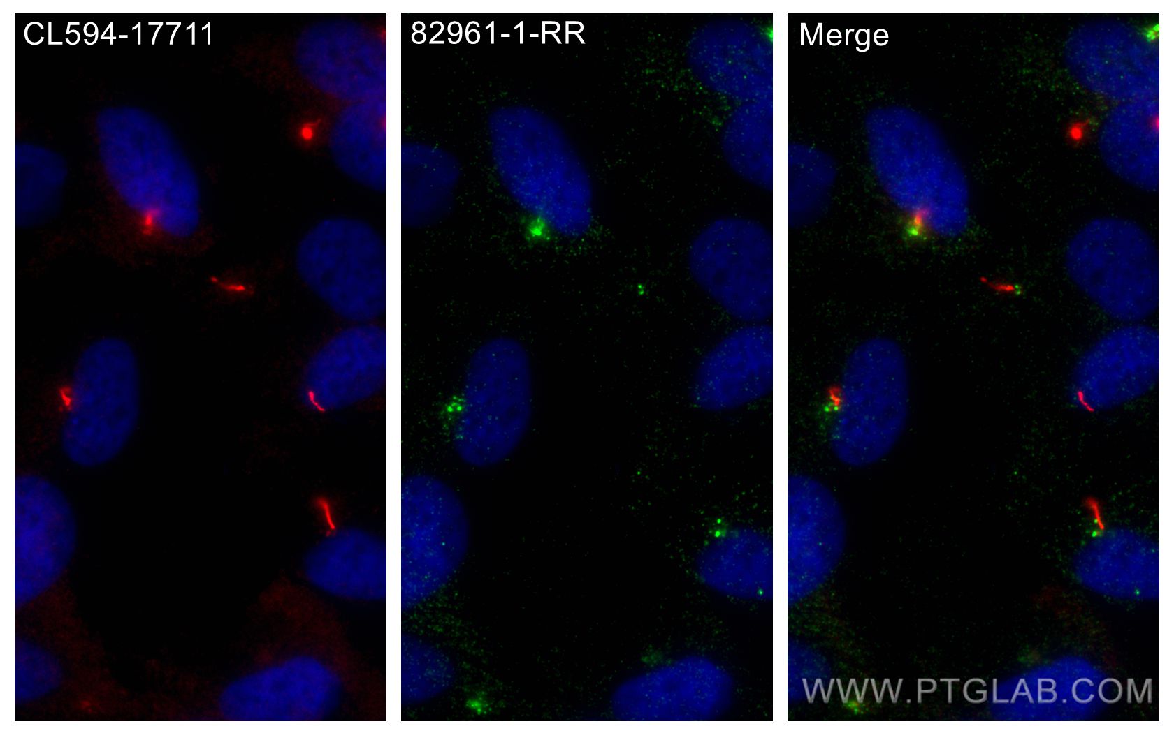 IF Staining of hTERT-RPE1 using 82961-1-RR