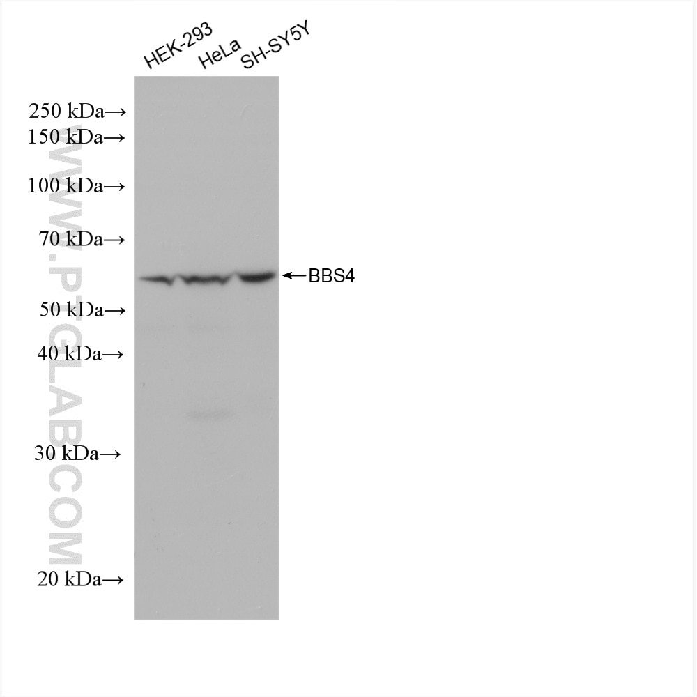 WB analysis using 82961-1-RR