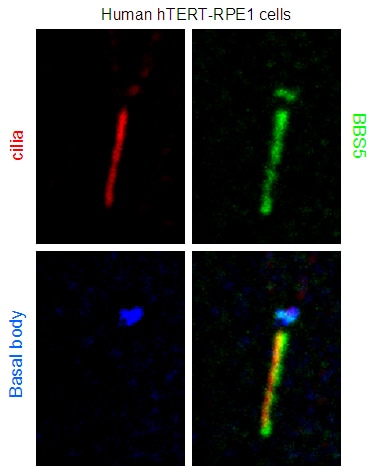 BBS5 Polyclonal antibody