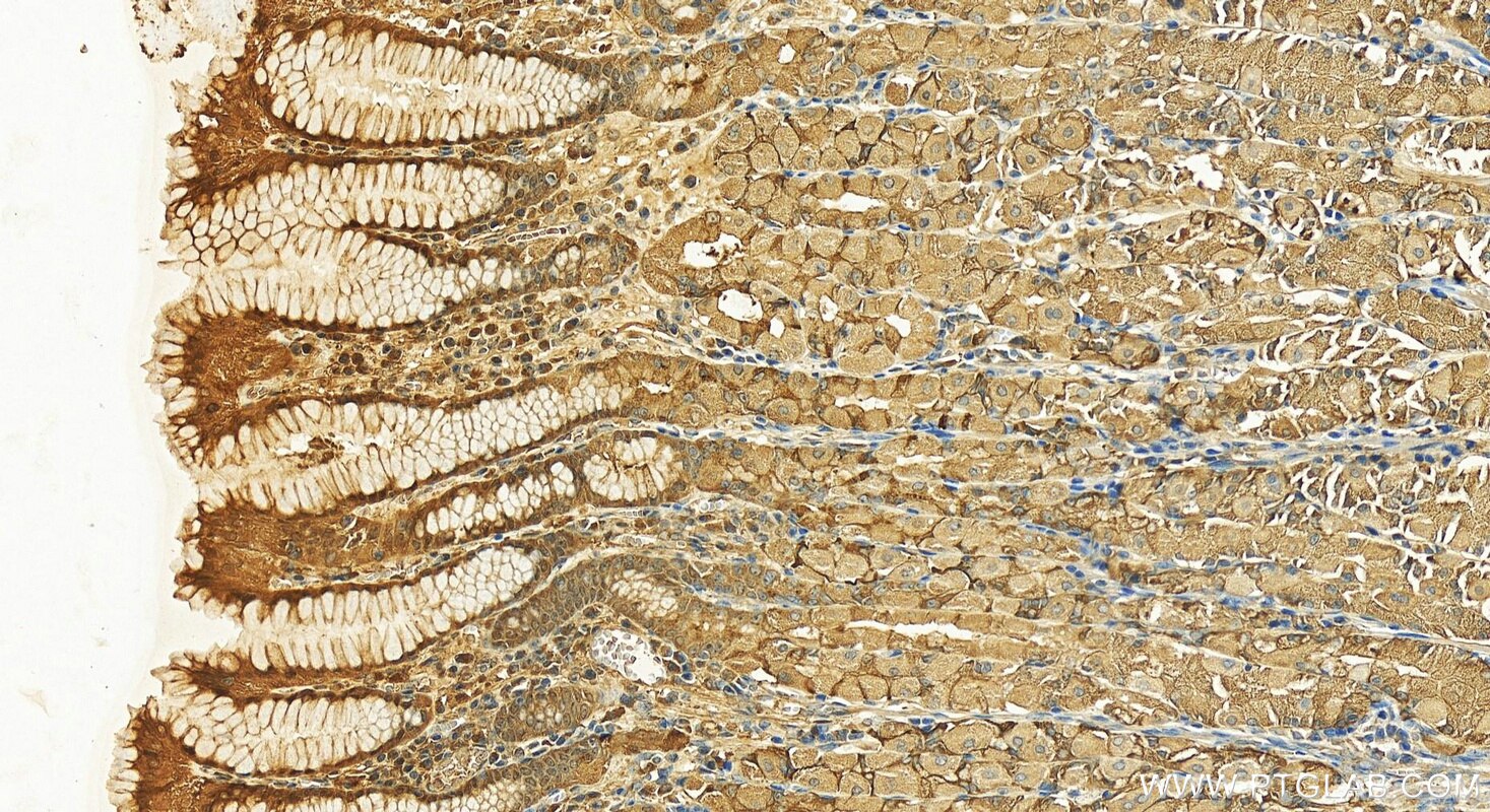 Immunohistochemistry (IHC) staining of human stomach tissue using BBS5 Polyclonal antibody (14569-1-AP)