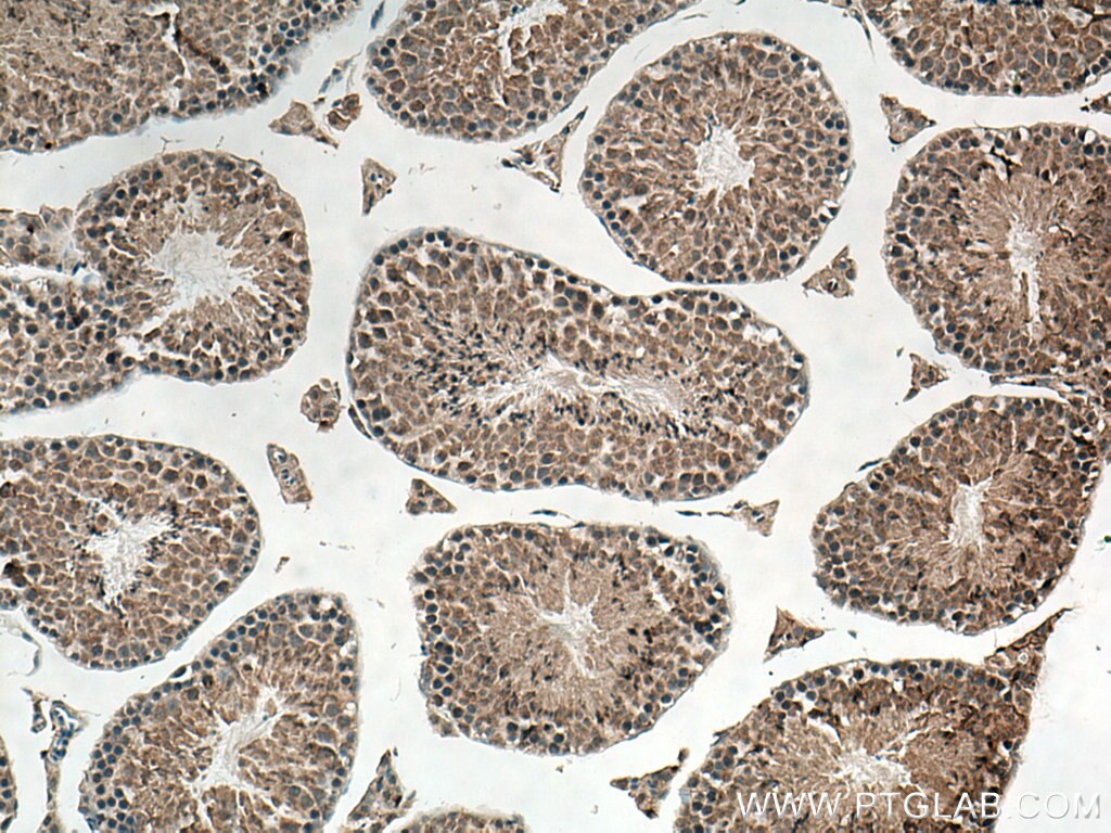 IHC staining of mouse testis using 14569-1-AP