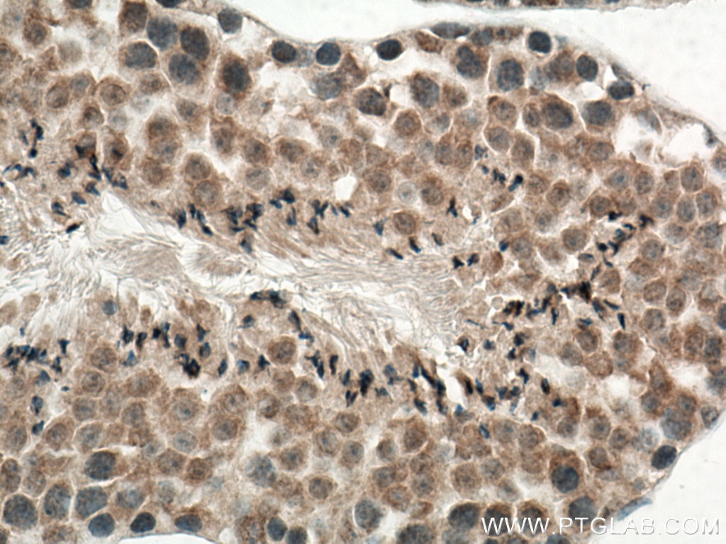 Immunohistochemistry (IHC) staining of mouse testis tissue using BBS5 Polyclonal antibody (14569-1-AP)