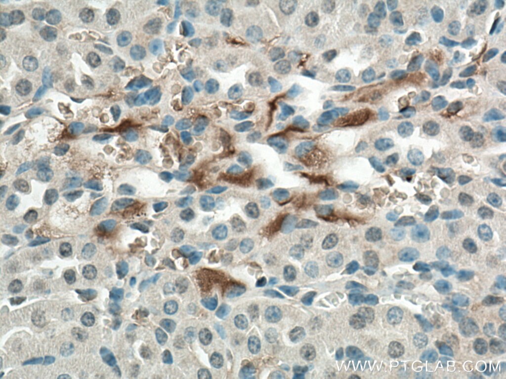 Immunohistochemistry (IHC) staining of mouse kidney tissue using BBS5 Polyclonal antibody (14569-1-AP)