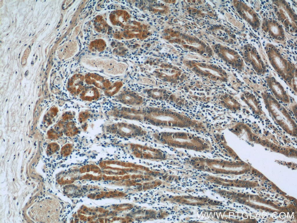 Immunohistochemistry (IHC) staining of human stomach tissue using BBS5 Polyclonal antibody (14569-1-AP)