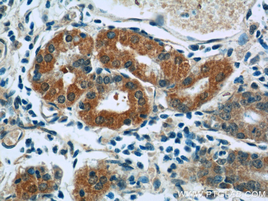 Immunohistochemistry (IHC) staining of human stomach tissue using BBS5 Polyclonal antibody (14569-1-AP)