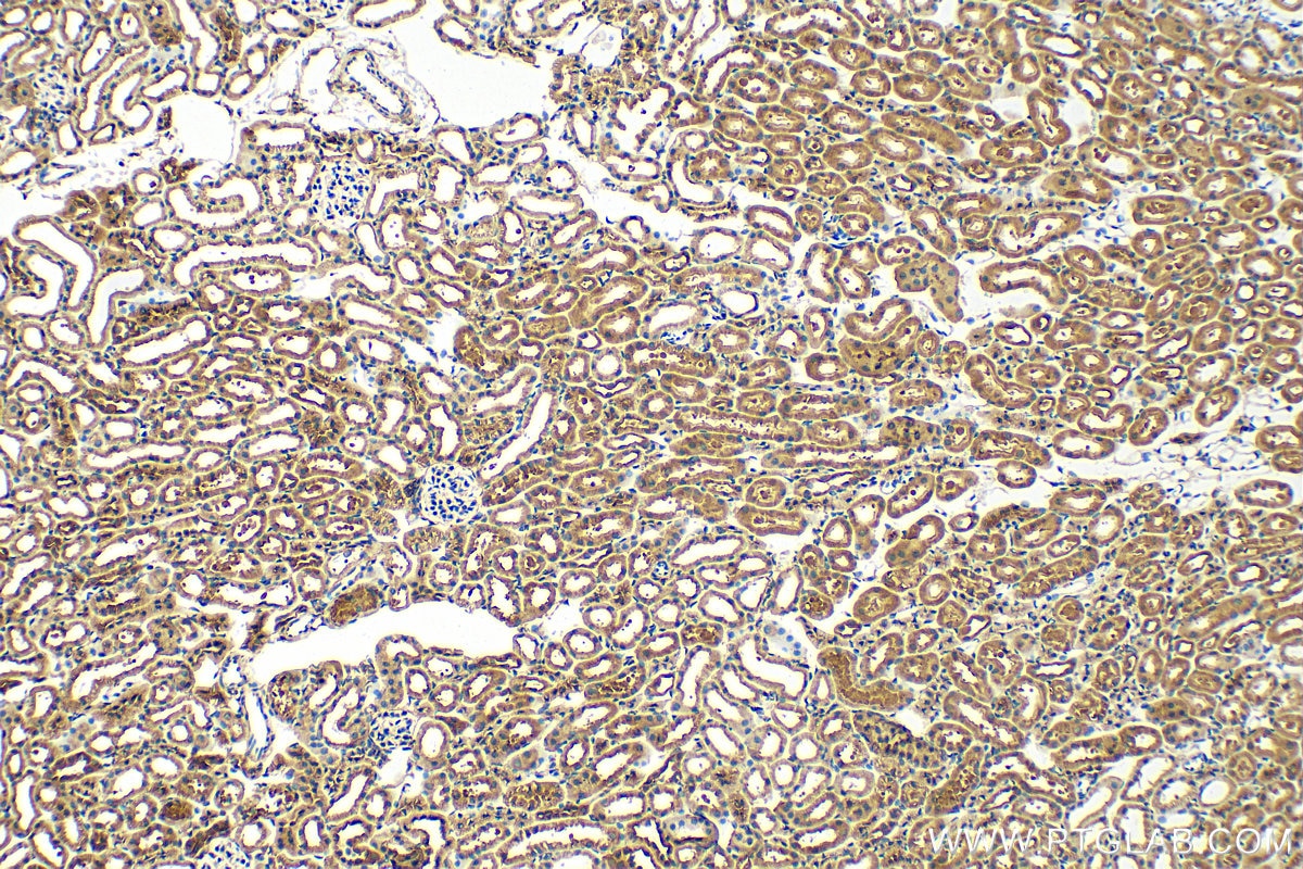 Immunohistochemistry (IHC) staining of mouse kidney tissue using BBS5 Polyclonal antibody (14569-1-AP)