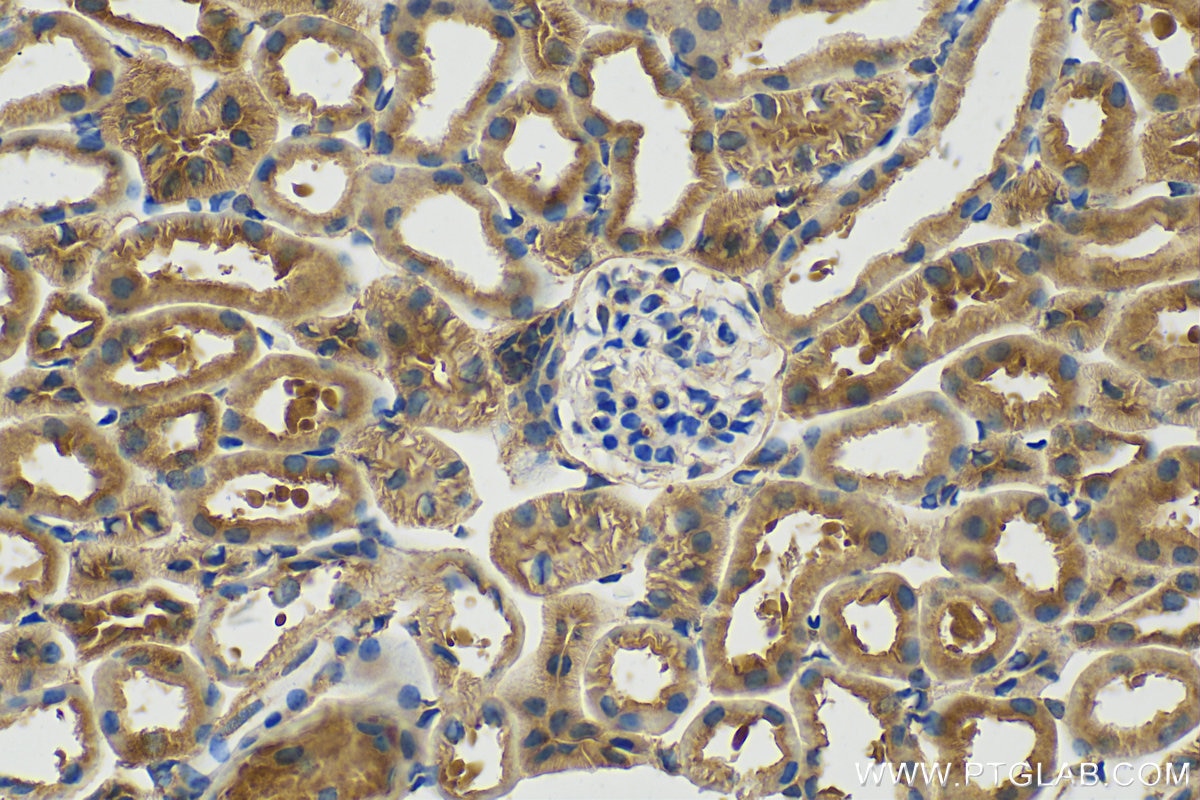 Immunohistochemistry (IHC) staining of mouse kidney tissue using BBS5 Polyclonal antibody (14569-1-AP)