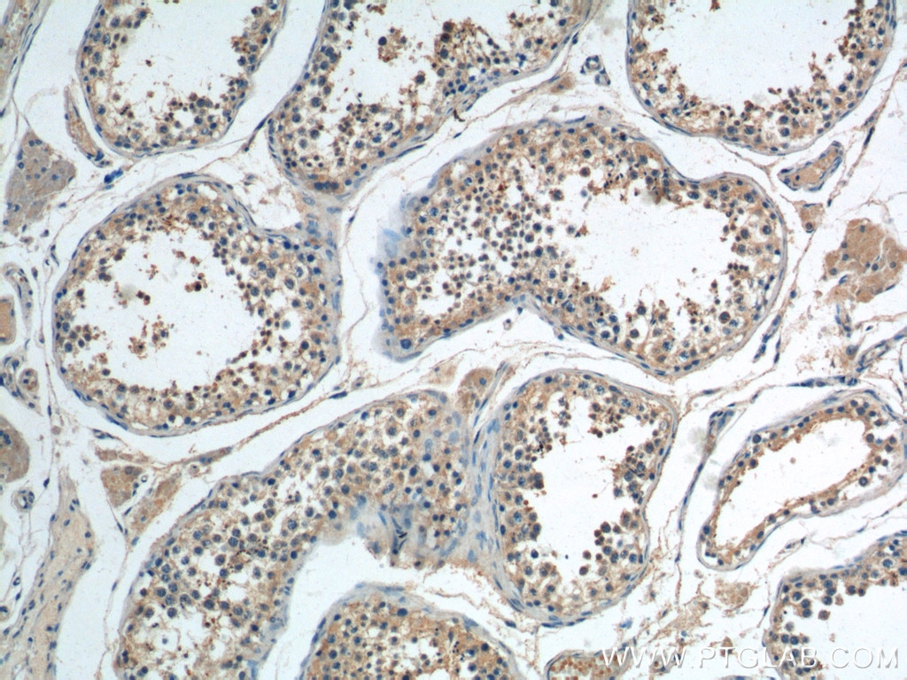 Immunohistochemistry (IHC) staining of human testis tissue using BBS5 Polyclonal antibody (14569-1-AP)