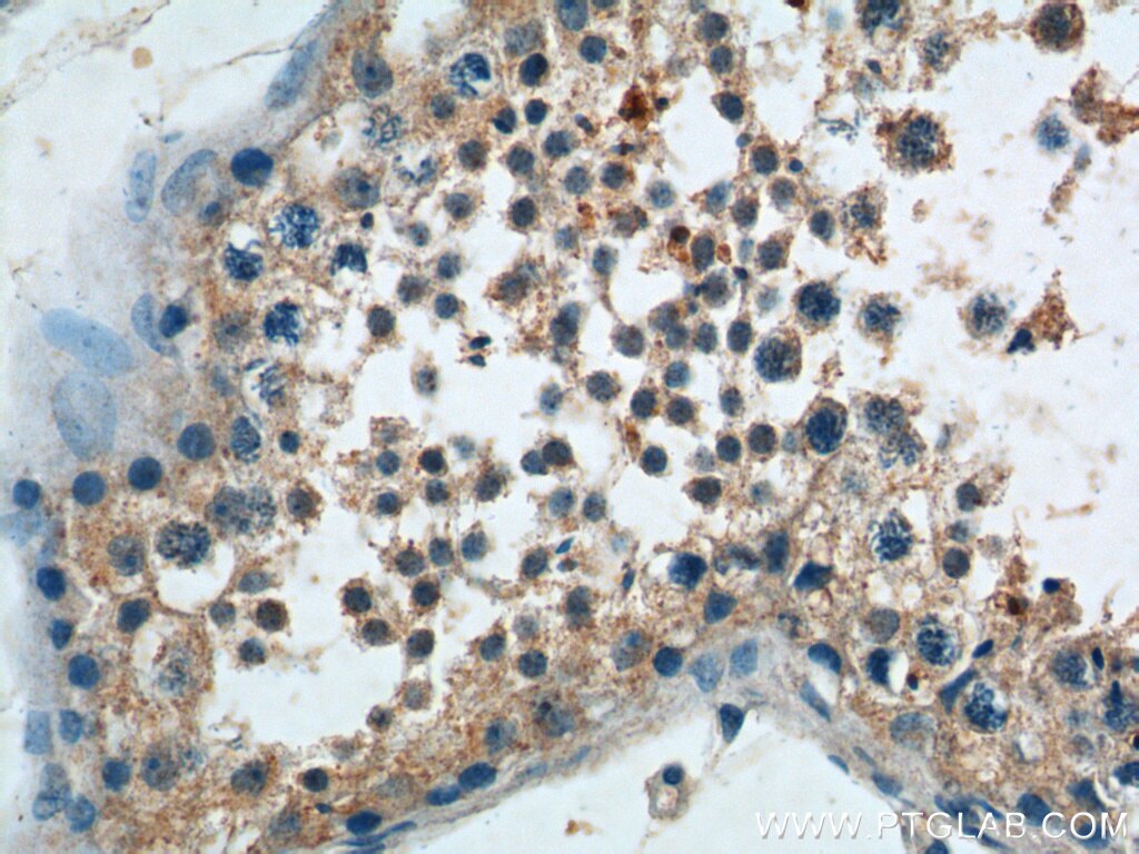 Immunohistochemistry (IHC) staining of human testis tissue using BBS5 Polyclonal antibody (14569-1-AP)