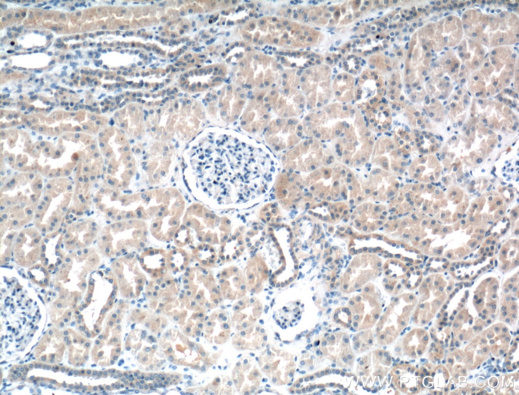 Immunohistochemistry (IHC) staining of human kidney tissue using BBS5 Polyclonal antibody (14569-1-AP)