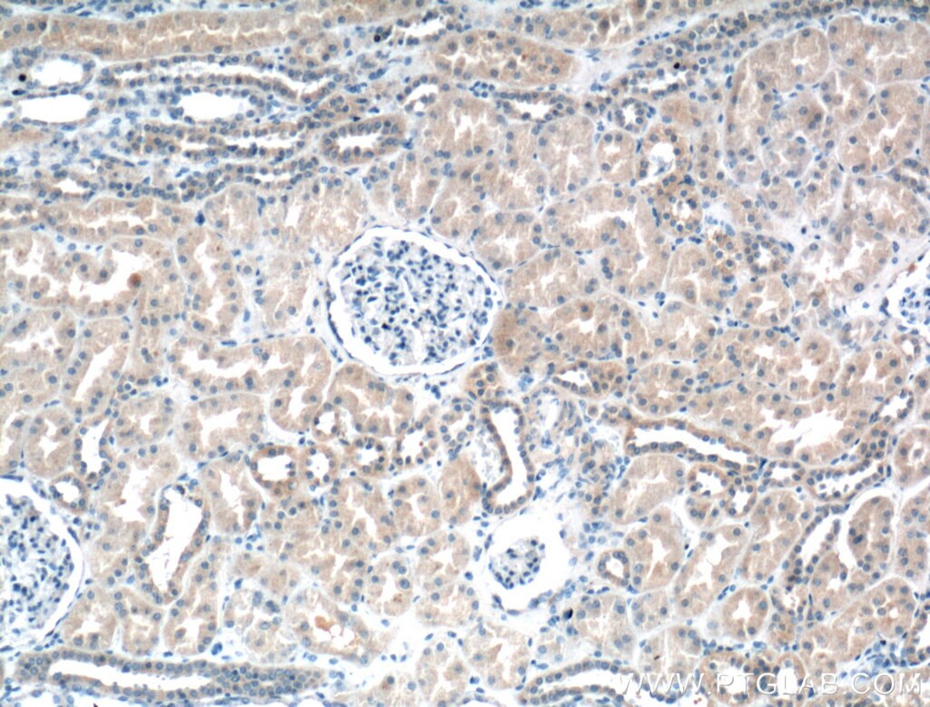 IHC staining of human kidney using 14569-1-AP