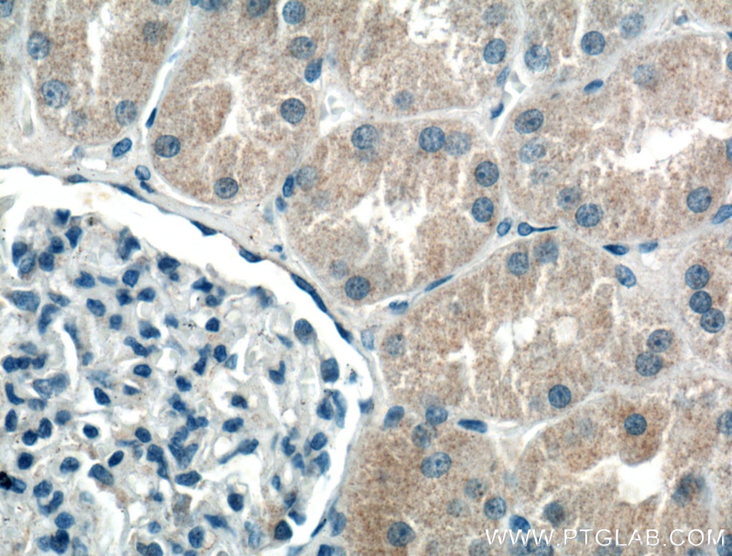 Immunohistochemistry (IHC) staining of human kidney tissue using BBS5 Polyclonal antibody (14569-1-AP)
