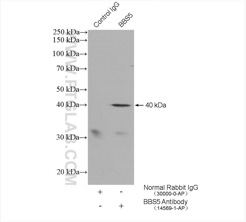 Immunoprecipitation (IP) experiment of mouse testis tissue using BBS5 Polyclonal antibody (14569-1-AP)