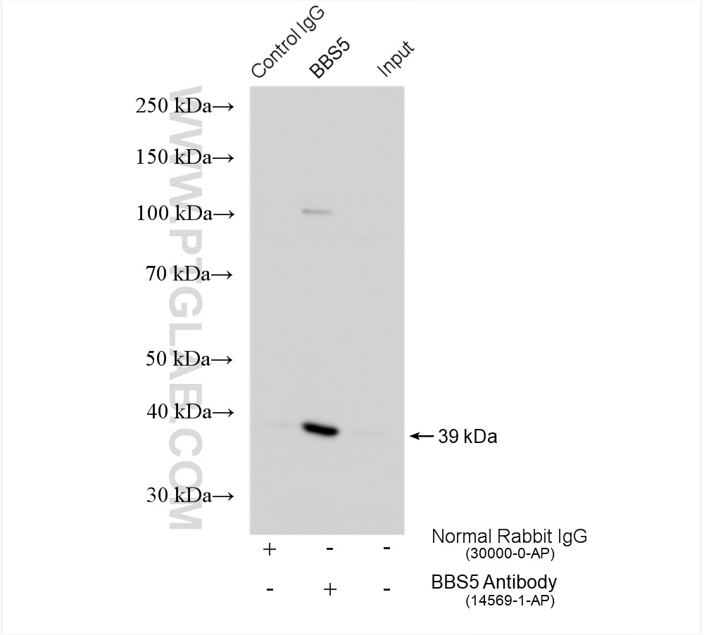 Immunoprecipitation (IP) experiment of mouse testis tissue using BBS5 Polyclonal antibody (14569-1-AP)