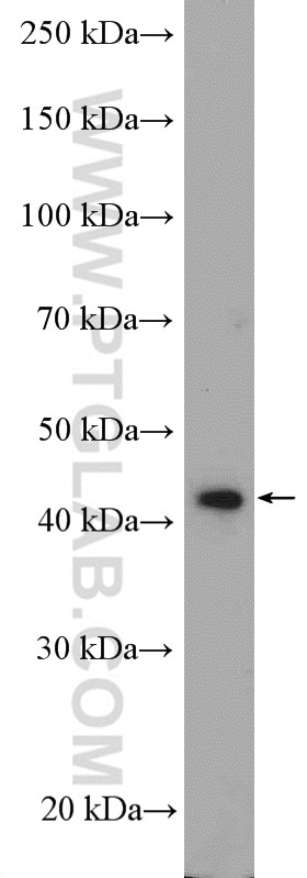Western Blot (WB) analysis of rat testis tissue using BBS5 Polyclonal antibody (14569-1-AP)