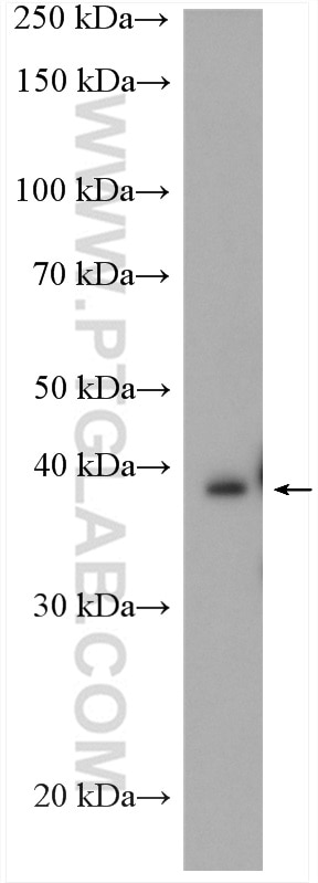 Western Blot (WB) analysis of mouse eye tissue using BBS5 Polyclonal antibody (14569-1-AP)