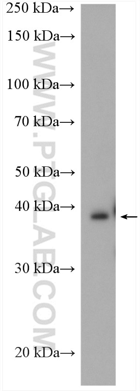 WB analysis of mouse eye using 14569-1-AP