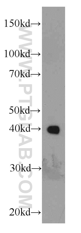 Western Blot (WB) analysis of human testis tissue using BBS5 Polyclonal antibody (14569-1-AP)