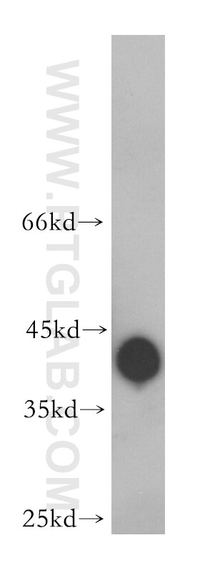 Western Blot (WB) analysis of mouse testis tissue using BBS5 Polyclonal antibody (14569-1-AP)