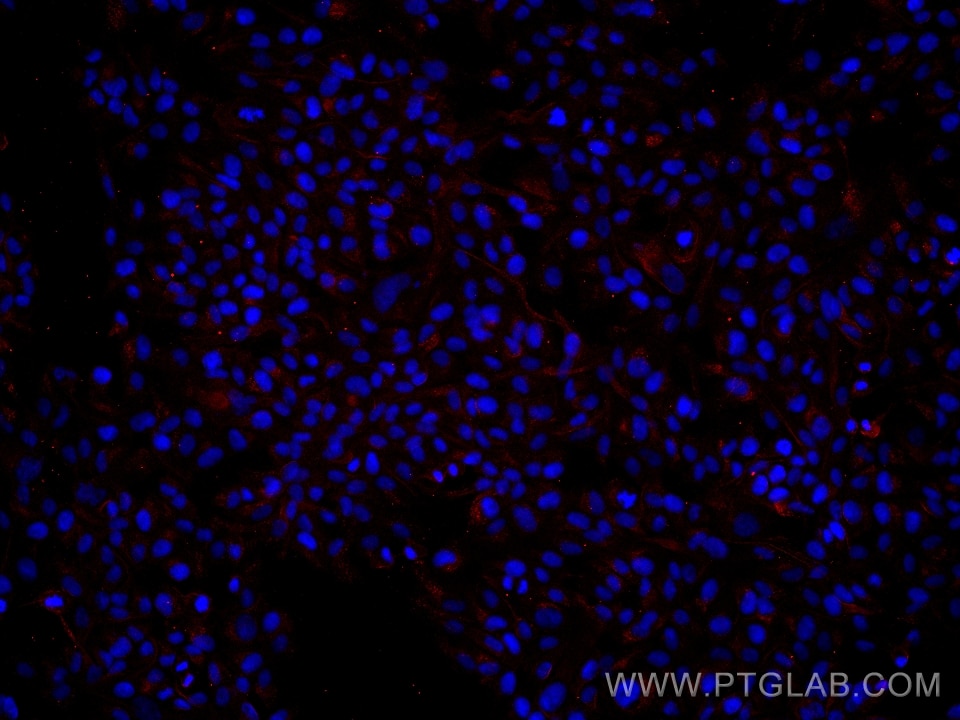 Immunofluorescence (IF) / fluorescent staining of hTERT-RPE1 cells using BBS5 Monoclonal antibody (66136-1-Ig)