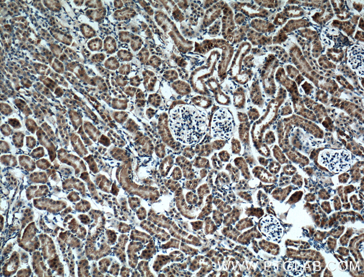 Immunohistochemistry (IHC) staining of mouse kidney tissue using BBS5 Monoclonal antibody (66136-1-Ig)