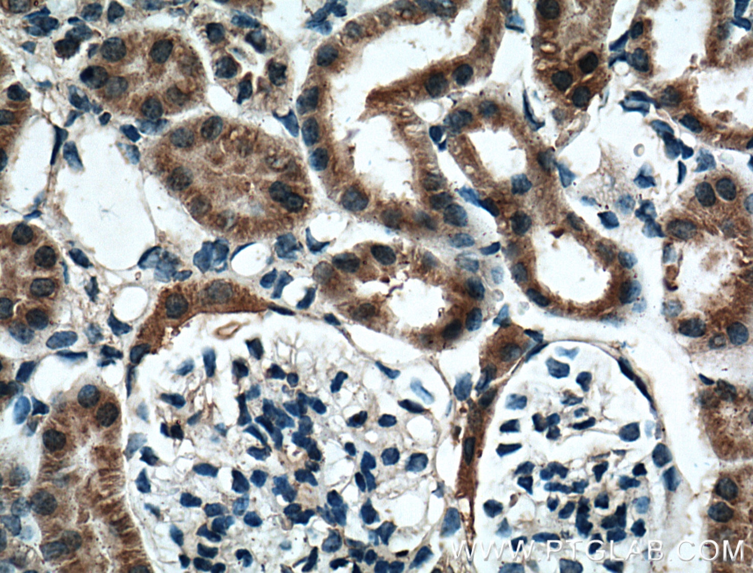Immunohistochemistry (IHC) staining of mouse kidney tissue using BBS5 Monoclonal antibody (66136-1-Ig)