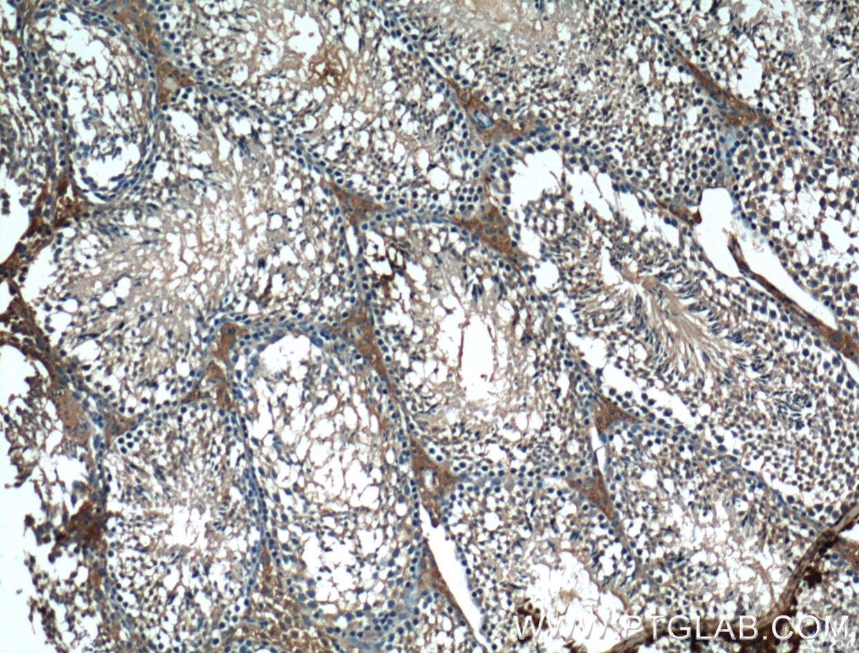 Immunohistochemistry (IHC) staining of mouse testis tissue using BBS5 Monoclonal antibody (66136-1-Ig)