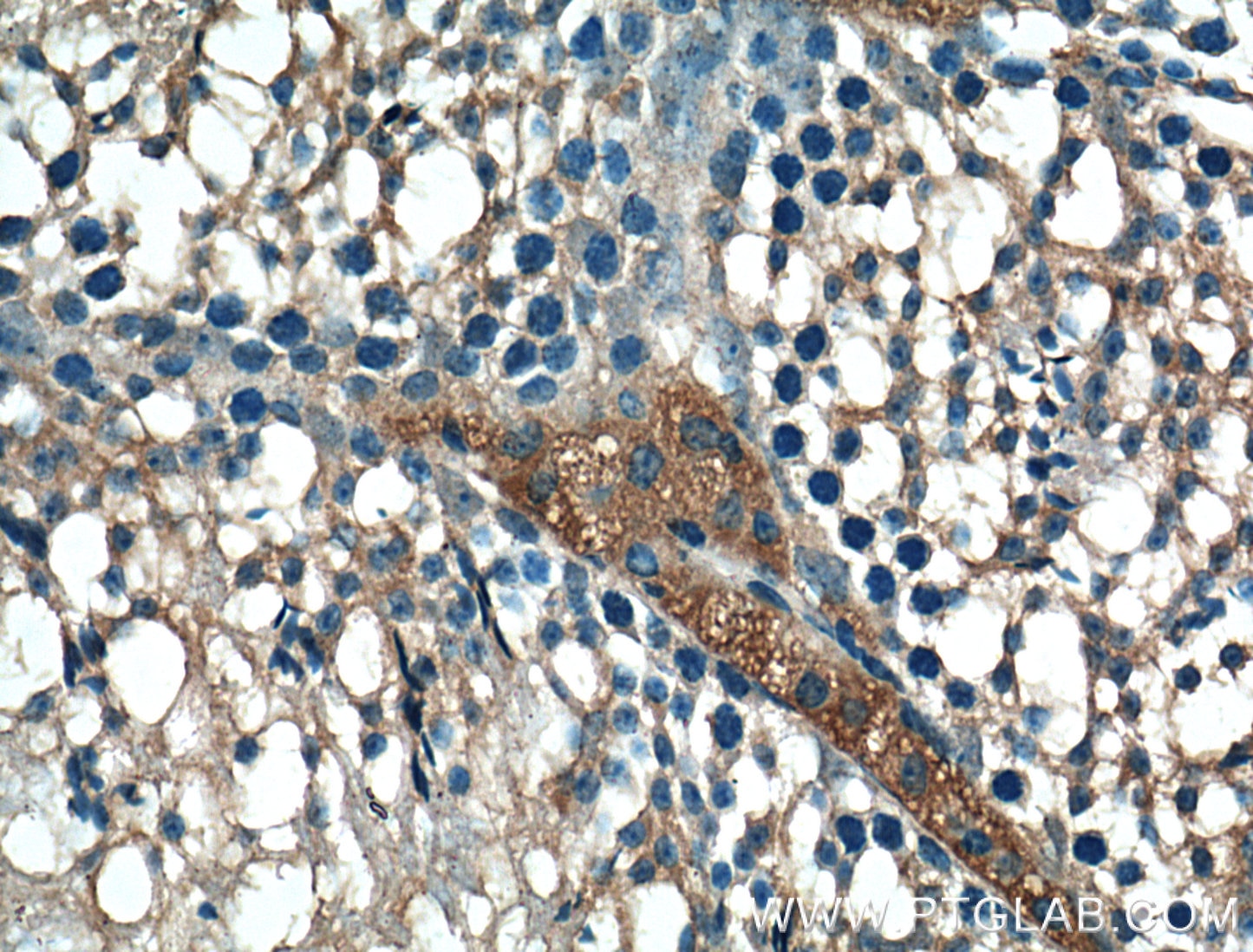 Immunohistochemistry (IHC) staining of mouse testis tissue using BBS5 Monoclonal antibody (66136-1-Ig)